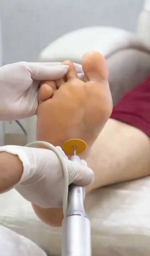 Lixamento da sola no spa dos pés — Amor In Beauty